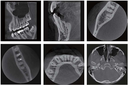 RAYSCAN Alpha Plus 130 3-in-1 CBCT