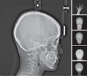 RAYSCAN Alpha Plus 130 3-in-1 CBCT