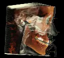 rayscan-vision-j