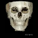 rayscan-vision-fov.webp