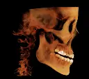 rayscan-vision-k.webp