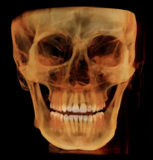 rayscan-vision-l.webp