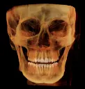 rayscan-vision-l.webp