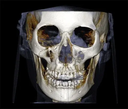 rayscan-vision-n.webp