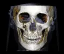 rayscan-vision-n.webp