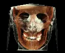 rayscan-vision-o.webp