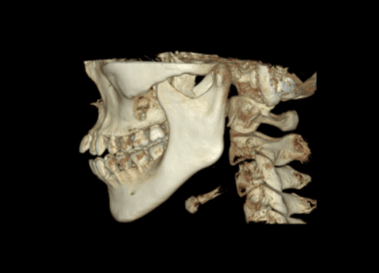 RAYSCAN Alpha Plus 16x10 FOV