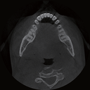 RAYSCAN Alpha Plus 130 3-in-1 CBCT