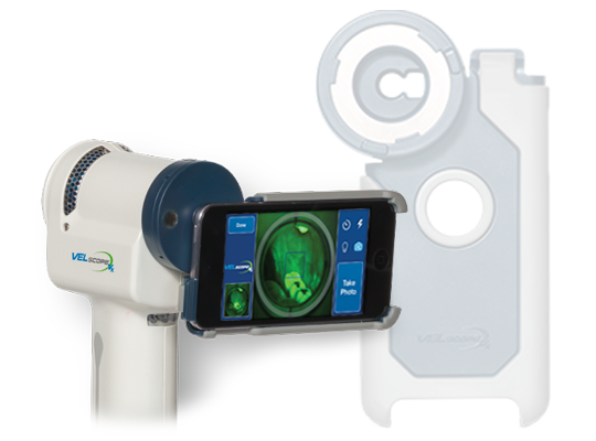 VELscope® Vx Imaging Adapter