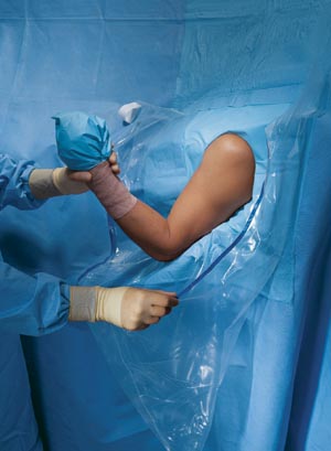 Halyard Drapes, Beach Chair Shoulder Arthroscopy Drape II, Sterile, 10/cs