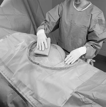 3M™ Steri-Drape™ Cesarean-Section Sheets with Incise Pouch, 35" x 30"