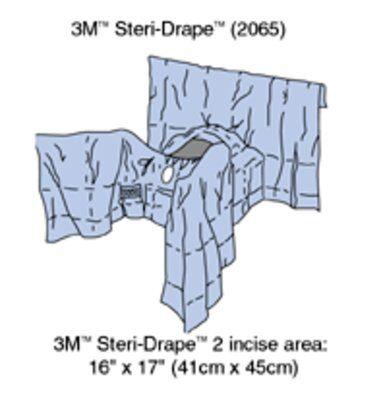 3M™ General Steri-Drape™ Abdominal Perineal Drape with Incise Film, 160&quot;, Lithotomy Position