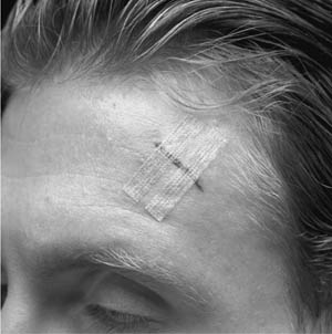 3M™ Steri-Strip™ Antimicrobial Skin Closures, ½" x 4", 6 strips/env