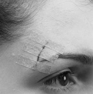3M™ Steri-Strip™ Adhesive Nonreinforced Skin Closure, Blendtone, ½" x 4", 6 strips/envelope
