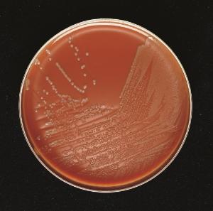 BD BBL Prepared Plated Media Chocolate II Agar w/ Hemoglobin and IsoVitalex, Dark Brown, 100/Pack