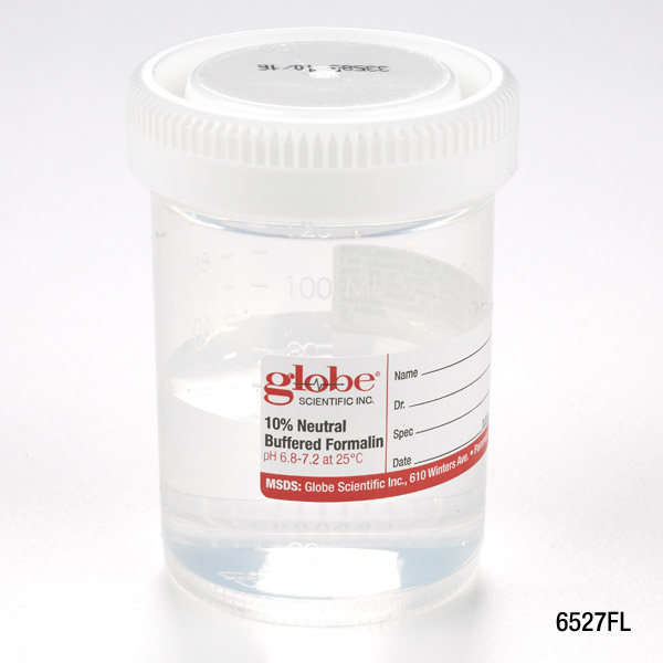 Globe Scientific Tite-Rite 120 ml PP Containers w/ 10% Neutral Buffered Formalin, 96/Case