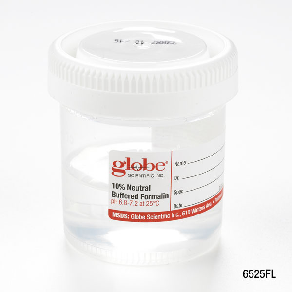 Globe Scientific Tite-Rite 90 ml PP Wide Mouth Containers w/ 10% Neutral Buffered Formalin, 96/Case