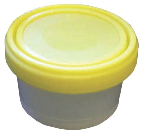 Globe Scientific 250 ml PP Large Capacity Histology Containers w/ Separate Yellow Screw Cap, 100/Case