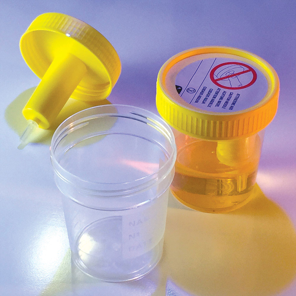 Globe Scientific TransferTop 120 ml Sterile Urine Collection Cups w/ Integrated Transfer Device, 300/Case