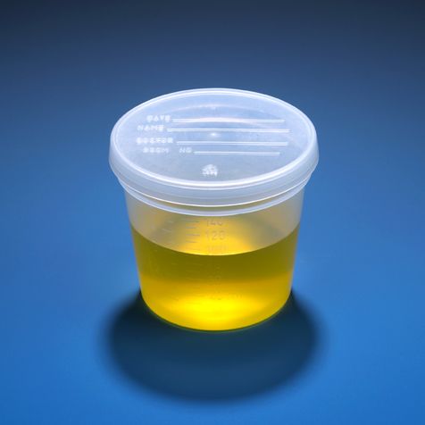 Globe Scientific 5 oz PP Specimen Collection Containers w/ Snap Cap, 300/Case