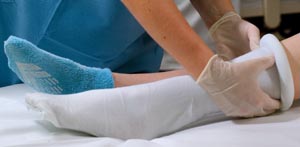 Alba Sterile Pre-Cut Double-Ply Stockinette, 3" x 36", 36/cs