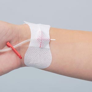Arterial Catheter Securement Device - Universal Winged Peripheral IV/Arterial Catheter, Sterile