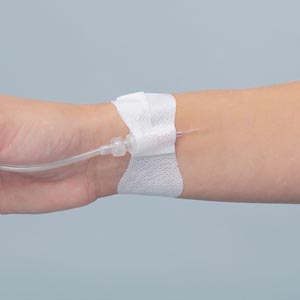 Arterial Catheter Securement Device - Universal Arterial & Peripheral IV Catheter, Sterile