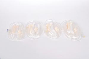 Exel IV Admin Set, 15 Drop/ml Lock Slip, NF Site, 78" Tubing