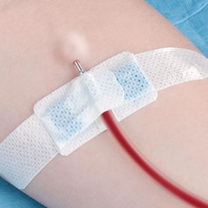 Tidi Grip-Lok® Specialty Securement Device - Dialysis Fistula Needle, Sterile
