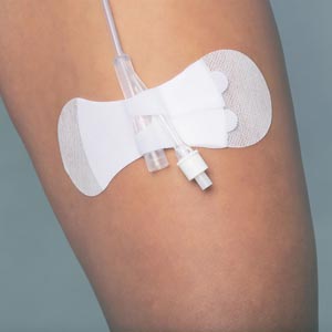 Tidi Grip-Lok® Foley Securement Device - Universal, L, Sterile, Individually Packaged, 100/bx
