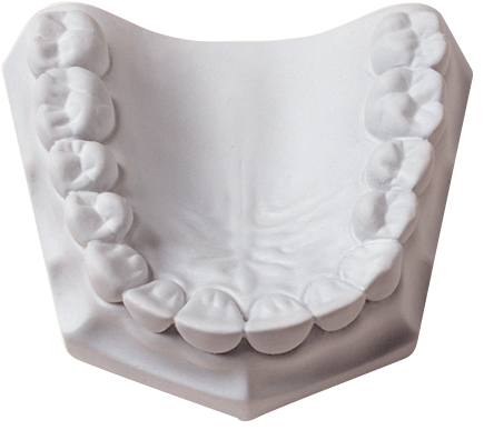 Whip Mix Mounting Plaster: Quick-Setting, Low-Strength, Low-Expansion (33 lb.)