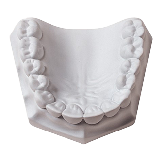 Whip Mix -Laboratory Plaster, White Fast Set
