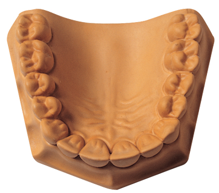 Whip Mix Microstone: Premium Dental Stone, Golden