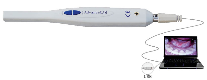 TPC AdvanceCAM USB Direct Intraoral Camera