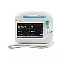 Welch Allyn Connex 6700 Series Vital Signs Monitor with Masimo SpO2, etCO2, SureTemp Plus, Printer and 3-Lead ECG