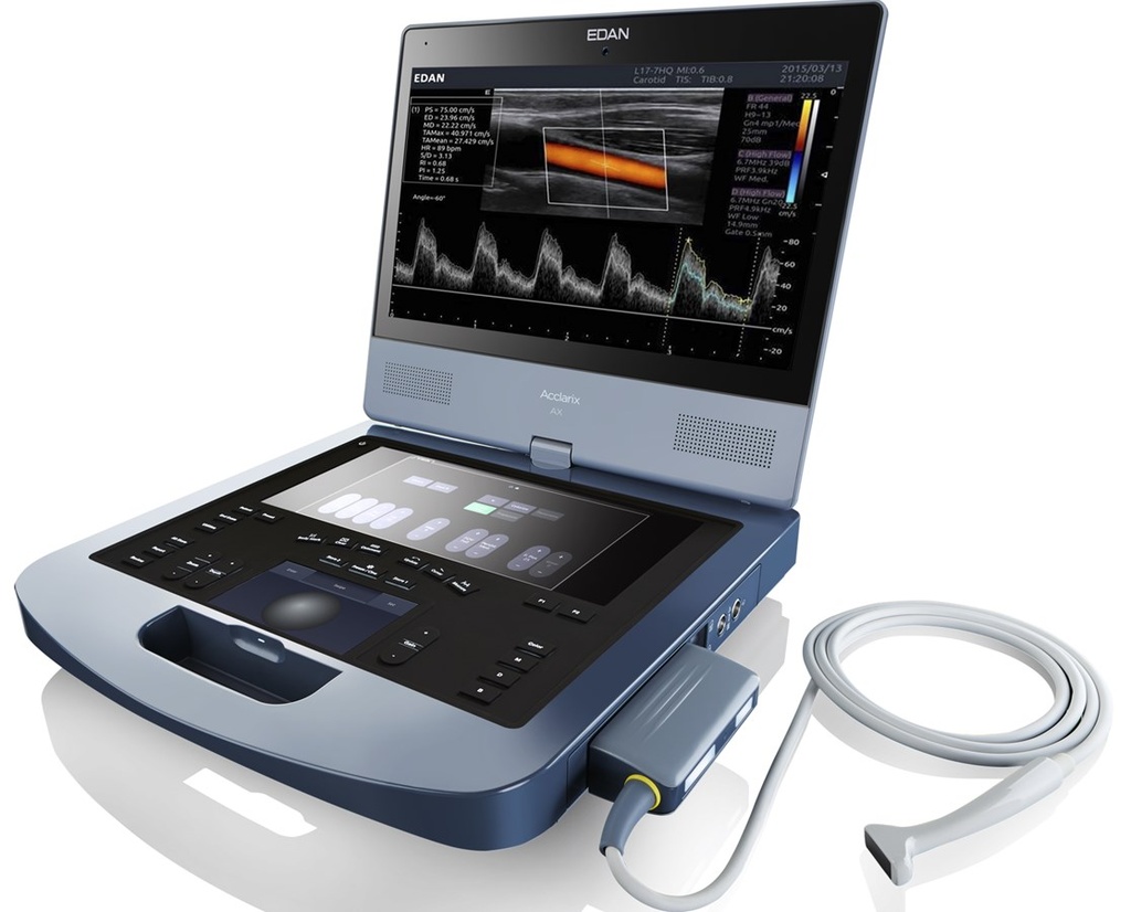 Edan Diagnostics Acclarix Ultrasound System