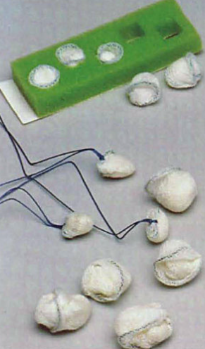 AMD-Medicom Sponge, Peanut, Small, 3/8", w/o String, X-ray Detectable, 5/ea, 20 pk/cs