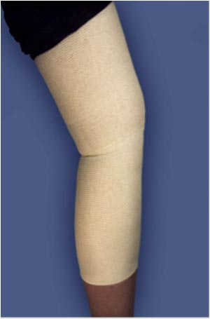 SpandaGrip Tubular Elastic Support Bandage, (F) Natural, Large Knees, Medium Thighs, 4"x36", 12/cs