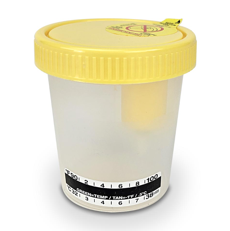 Globe Scientific Urine Collection Containers