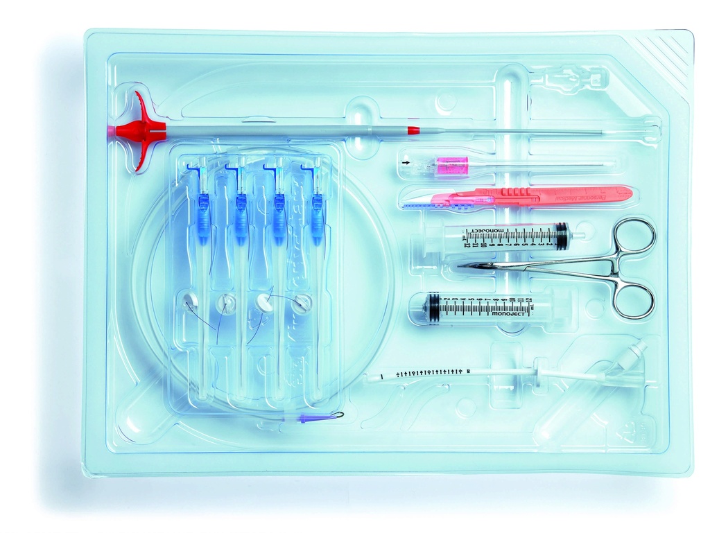 Avanos 18 Fr Introducer Kit for Gastrostomy Feeding Tube