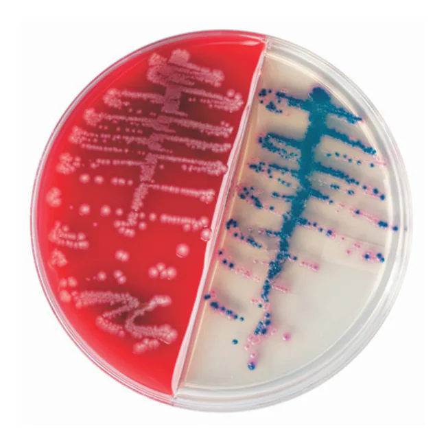 CHROMagar™ Orientation and BD Trypticase™ Soy Agar II I-Plate, 100/pk