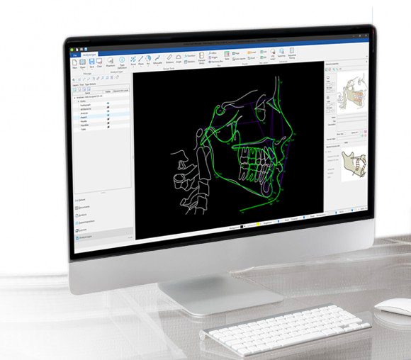 Cephalometric analysis and tracing module using A.I. (artificial intelligence)
1 floating license