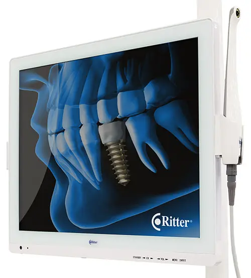 A3W-X Intraoral Camera Mount and Monitor Included