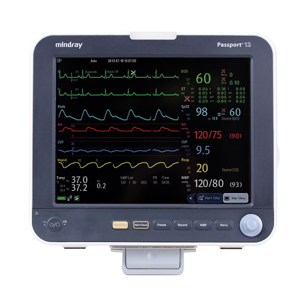 Mindray Passport 12m - ECG/Reps, SPo2, Nibp, Temp w/ AG analyzer
