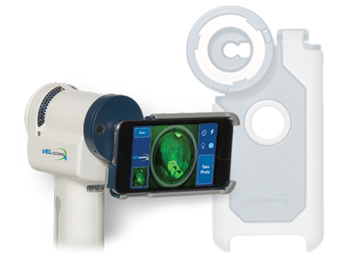 [4405] VELscope® Vx Imaging Adapter