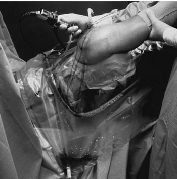 [1067] 3M™ Steri-Drape™ U-Drapes, 30" x 35", U-Pouch Aperture with Adhesive, 2 Exit Ports