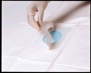 [698] Busse Towels/Drapes, 3" Round Fenestration, Sterile, Adhesive Patch Around Fenestration