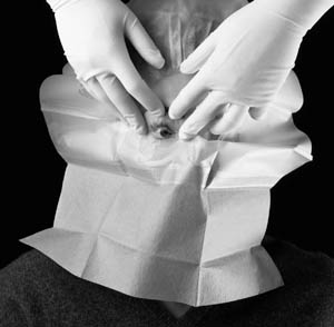 [1023] 3M™ Steri-Drape™ Ophthalmic Surgical Drapes Small with Incise Film & Pouch, 15" x 19"
