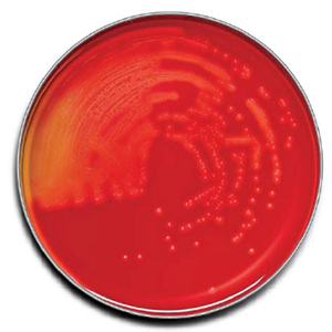 [221261] BD BBL Trypticase Soy Agar with 5% Sheep Blood Plate, 100/Pack