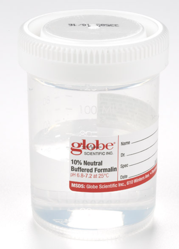 [6527FL] Globe Scientific Tite-Rite 120 ml PP Containers w/ 10% Neutral Buffered Formalin, 96/Case